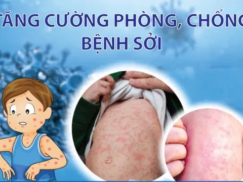 Infographics: Tăng cường công tác phòng, chống bệnh Sởi
