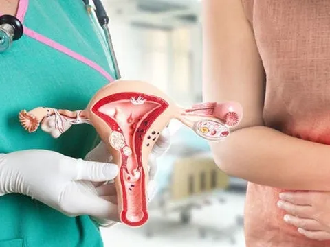 Tiền ung thư cổ tử cung và những dấu hiệu cần lưu ý