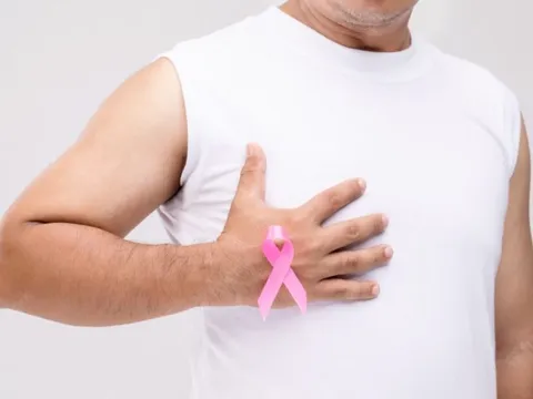 Ung thư vú ở nam giới chữa được không?
