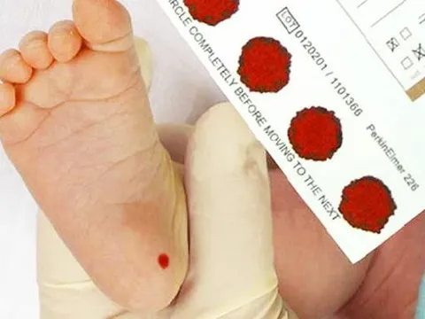 Sàng lọc trước sinh và sơ sinh - tránh hậu quả nặng nề do dị tật