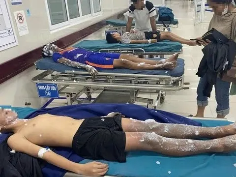 4 học sinh bỏng nặng sau khi tự chế pháo nổ theo Youtube