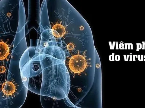 Tổ chức Y tế thế giới thông tin về bệnh do virus gây viêm phổi ở Trung Quốc