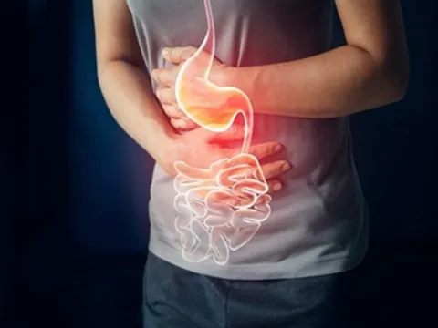 Phát hiện hàng trăm con giun bám trắng ruột người phụ nữ