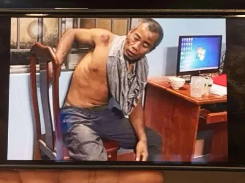 Khởi tố người đàn ông chém Thượng úy công an bị thương