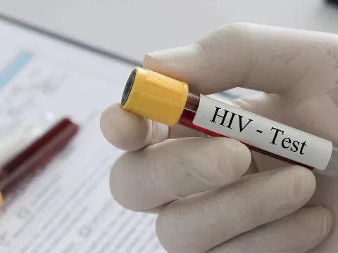 Liên hợp quốc cảnh báo nguy cơ bùng phát đại dịch HIV/AIDS sau quyết định cắt giảm tài trợ của Hoa Kỳ