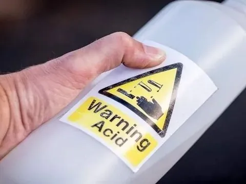 Cô gái bị tạt axit vì từ chối lời cầu hôn vào ngày 14/2