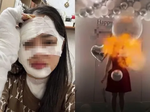 Cảnh báo nguy hiểm từ bóng bay bơm khí Hydro