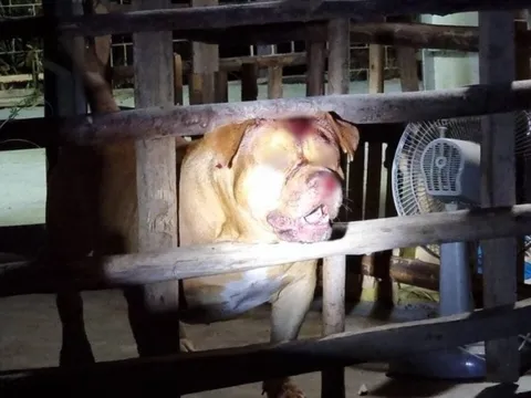 Đang ngủ, bé gái bị chó Pitbull nhà hàng xóm cắn nguy kịch