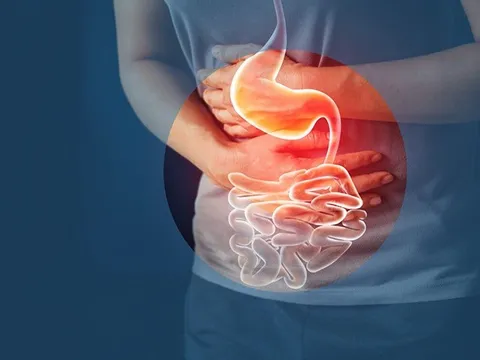 Ăn măng bị hóc, cụ ông bị vỡ dạ dày do người thân sơ cứu sai cách