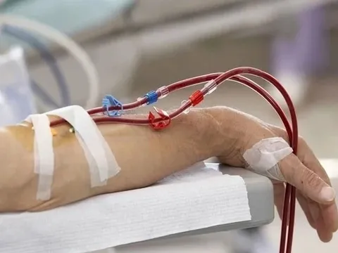 Rà soát quảng cáo 'kỹ thuật lọc máu công nghệ cao loại bỏ mỡ máu, giảm nguy cơ đột quỵ'