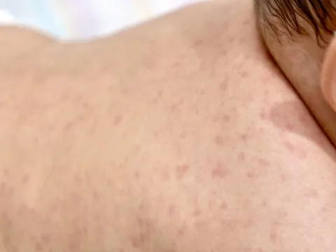 Bộ Y tế thông tin về 2 trẻ tử vong 'chưa rõ nguyên nhân' tại Quảng Nam