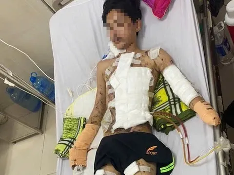Nam sinh bị thương nặng, mất một bàn tay khi tự chế pháo nổ