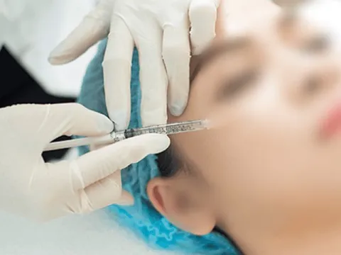 Cầu cứu bác sĩ sau khi chi hàng chục triệu đồng tiêm filler làm đẹp