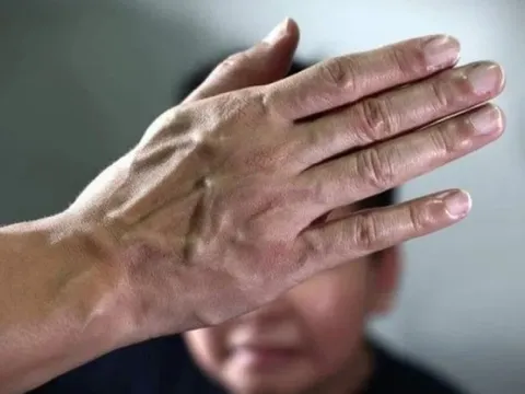 Gọi thẳng tên thầy giáo, cậu bé bị tát 9 cái