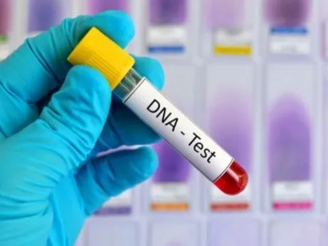 Rủ nhau đi xét nghiệm ADN, đôi bạn thân phát hiện bí mật động trời