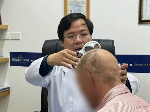 Rụng tóc mảng cả đầu, bác sĩ cảnh báo sai lầm nguy hiểm