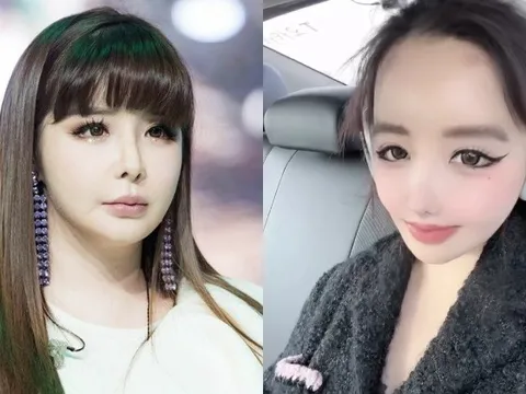 Gương mặt ngày càng khác lạ của Park Bom (2NE1)