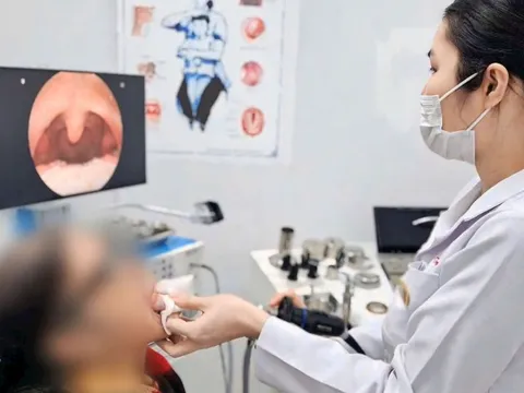 Ho kéo dài, đi khám, cụ bà 79 tuổi bất ngờ trước thông báo của bác sĩ