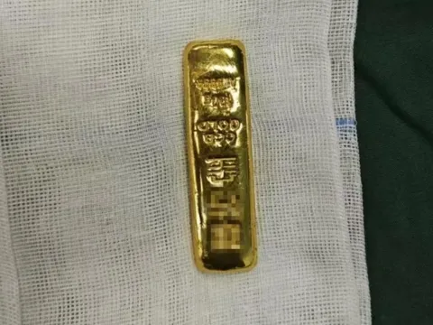 Tò mò, cậu bé 11 tuổi nuốt thỏi vàng vào bụng