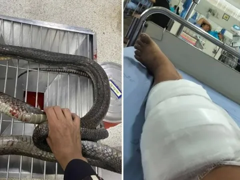 Bị rắn hổ mang cắn, người phụ nữ 47 tuổi tay không hạ gục con rắn rồi mang đến bệnh viện