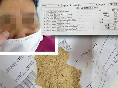 Uống thuốc mua qua mạng chứa "chất cấm", cụ bà bị suy thận cấp