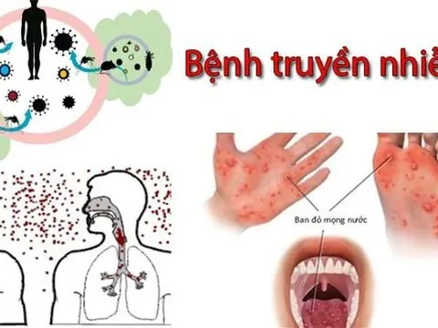 Nhiều bệnh truyền nhiễm đang có xu hướng gia tăng