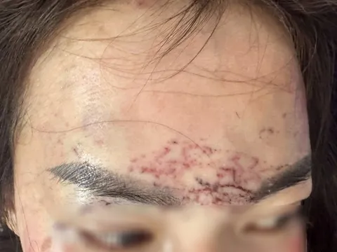 Khởi tố vụ người phụ nữ bị cắt tóc, xăm trán, đánh đập gây thương tích để điều tra