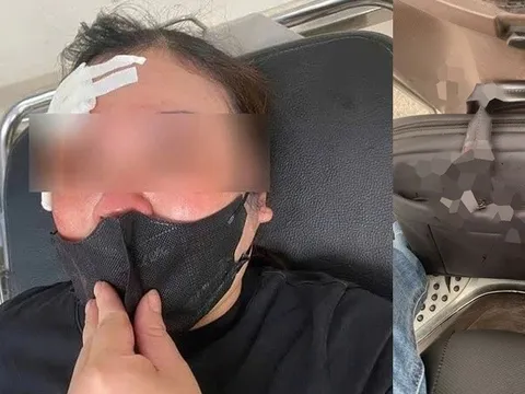 Nguyên nhân vụ người phụ nữ đi xe máy bị đánh vào đầu ở Hà Nội