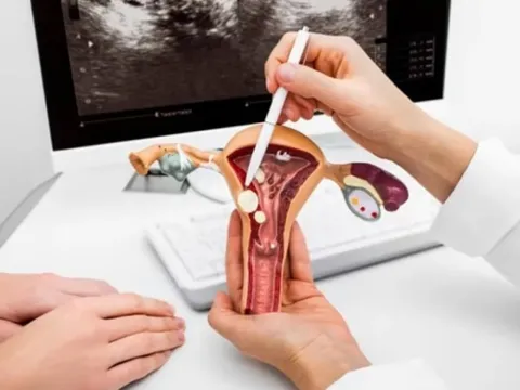 Cảnh báo biến thể ung thư cổ tử cung hiếm gặp do HPV type 18: âm thầm, khó phát hiện, dễ bỏ sót