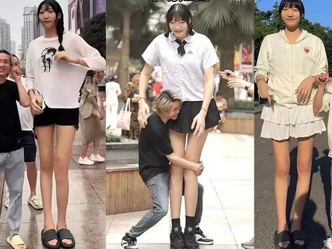 Chàng trai "tí hon" yêu say đắm cô gái "khổng lồ" cao 2m2, biết lý do ai cũng bất ngờ