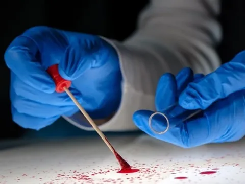 Chấn chỉnh hoạt động giám định pháp y, pháp y tâm thần