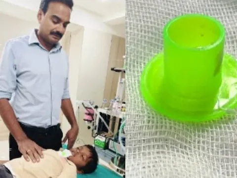 Bé trai đau họng đi khám, bác sĩ sốc nặng khi lấy ra thứ bên trong