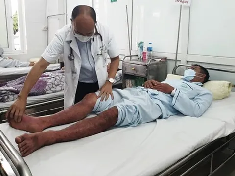 Sốt xuất huyết Dengue: Đừng để nguy kịch vì chủ quan