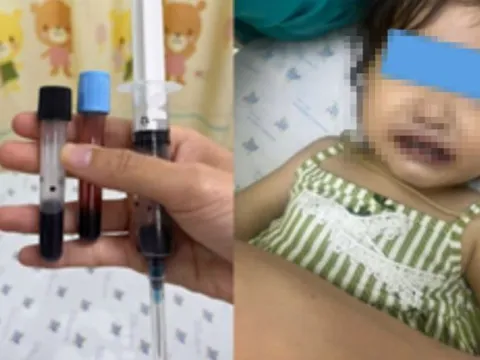 Ăn canh nấu bằng nước giếng, máu của bé gái 16 tuổi chuyển màu nâu đen