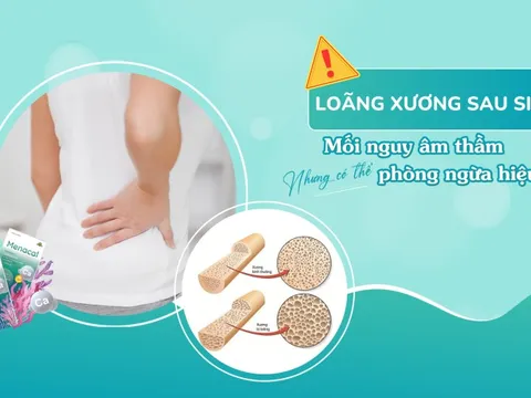 Loãng xương sau sinh: Mối nguy âm thầm nhưng có thể phòng ngừa hiệu quả