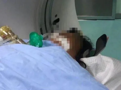 Loại rau chứa chất độc cực mạnh, 3 người trong một gia đình nguy kịch sau khi ăn