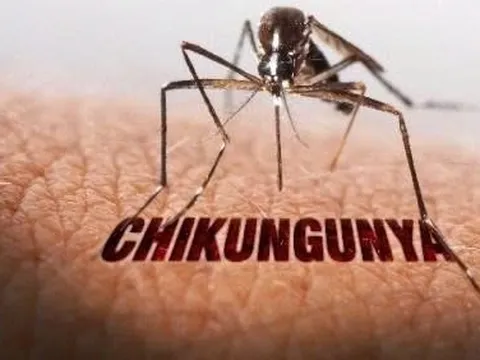 Bộ Y tế nói về các kịch bản ứng phó nguy cơ lây lan bệnh Chikungynya