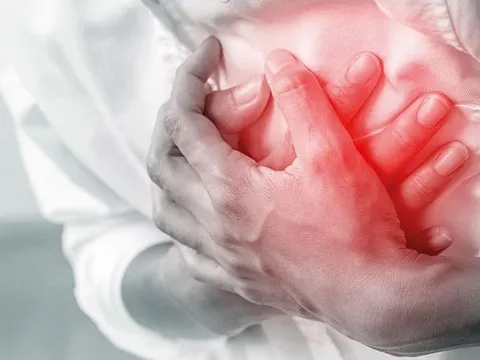 Lên cơn đau tim khi đang đi khám bệnh, bác sĩ phẫu thuật tim tử vong