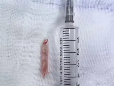 Chụp CT cho người phụ nữ, bác sĩ phát hiện ra "bí mật" đáng sợ