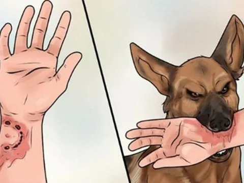 Cách tốt nhất phòng tránh bệnh dại