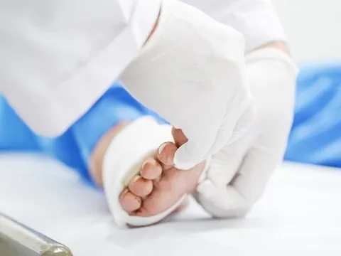 Khám chân cho người đàn ông 45 tuổi, bác sĩ sốc nặng khi phát hiện "bí mật đáng sợ"