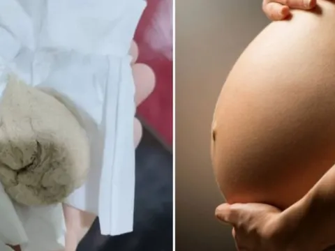 Đau vùng kín suốt 1 tháng sau sinh,người phụ nữ sốc nặng khi phát hiện "vật lạ" trong cơ thể