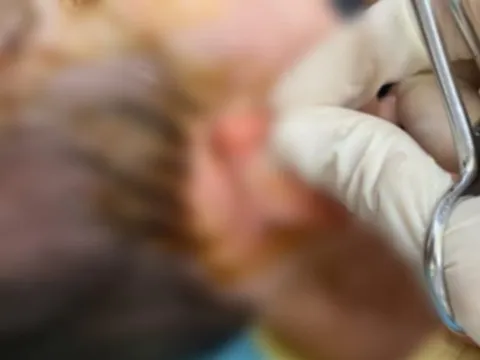 Bé gái 19 tháng tuổi bị chó cắn nhập viện: Chủ chó bị xử lý như thế nào?