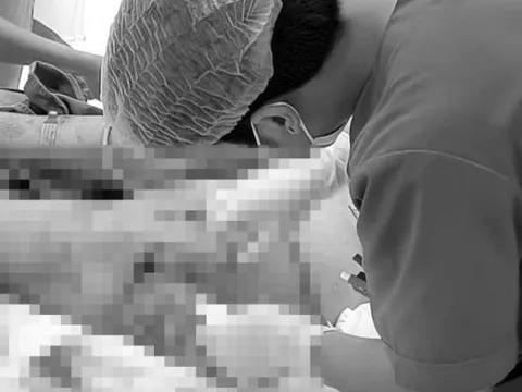 Cụ ông 76 tuổi sốc nhiễm khuẩn, hoại tử vùng đùi vì sai lầm phổ biến