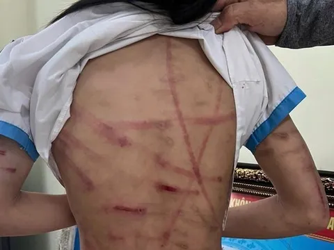 Thương bao nhiêu, giận bấy nhiêu...