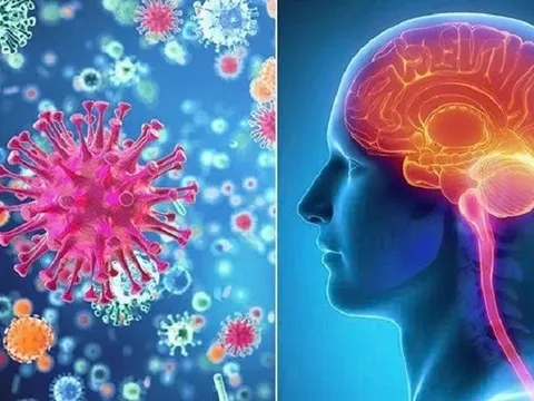 Cảnh báo các ca bệnh não mô cầu xâm lấn: Bệnh không phổ biến nhưng rất nguy hiểm