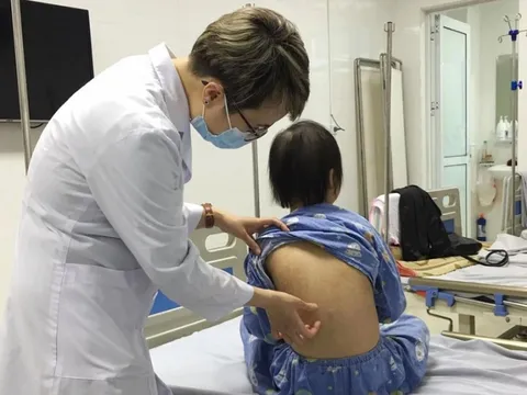 Bệnh da liễu ở trẻ em