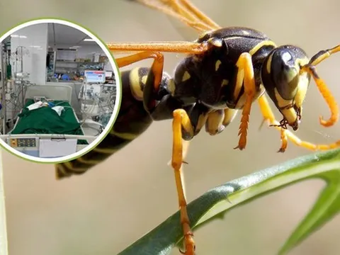 Bị ong vò vẽ đốt, bé gái 9 tuổi nguy kịch