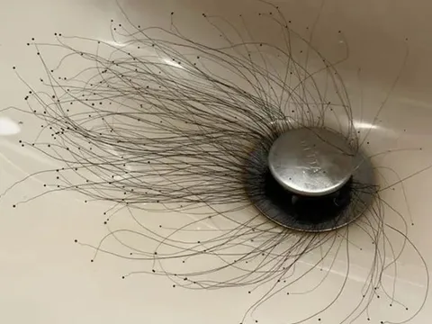 Người đàn ông sốc nặng khi thấy thứ đáng sợ mọc ra từ bồn rửa mặt