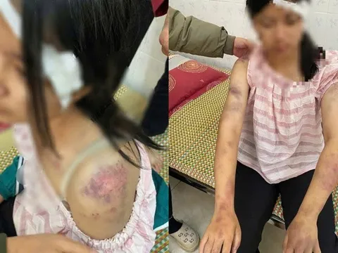 Góc nhìn pháp lý vụ bà nội cùng 2 đồng phạm tra tấn tàn nhẫn cháu ruột suốt nhiều tiếng đồng hồ